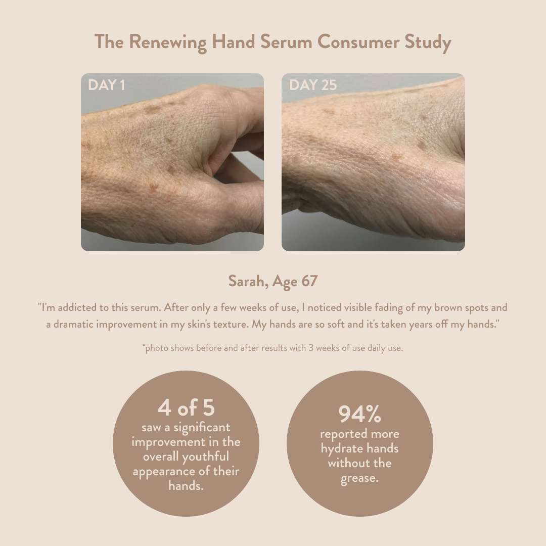 Hand serum consumer study showing before and after effects on a hand with visible reduction of wrinkles.
